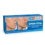 до и после крем-гель анти-акне д/проблем кожи 50мл